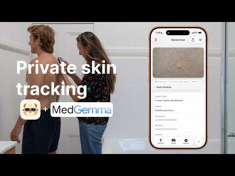Introducing Sunny - A MedGemma-Powered Skin Health Tracking App (Kaggle Competition Entry)
