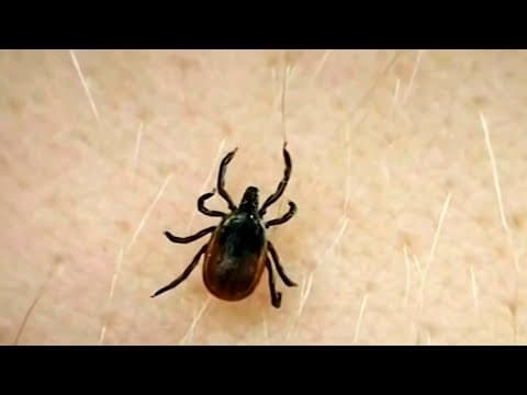 Aumentan visitas a urgencias por picaduras de garrapatas