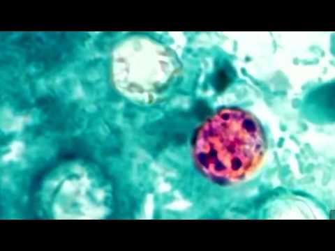 Sigue aumento de casos por ciclosporiasis
