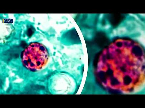 CDC amplía alerta por ciclospora